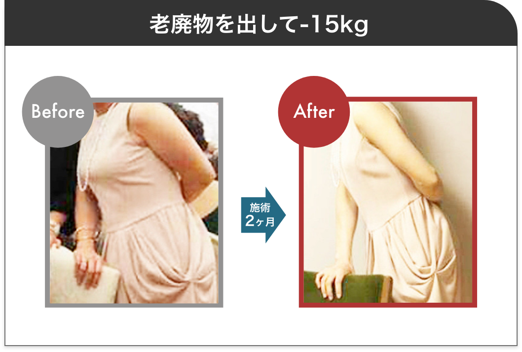 老廃物を出して-15kg