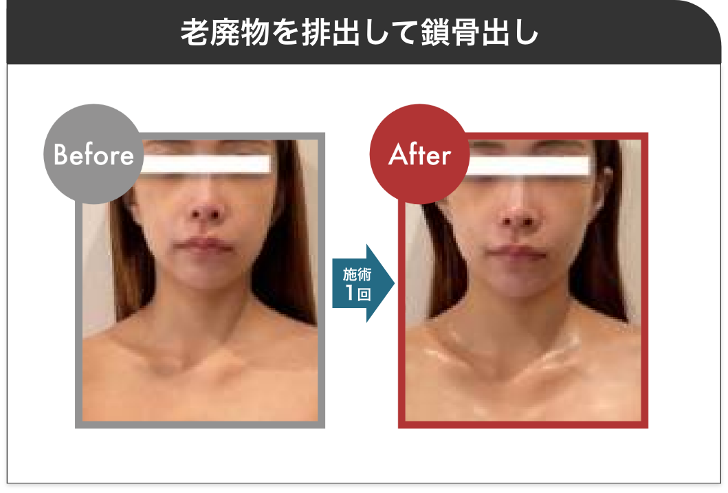 老廃物を出して鎖骨だし